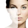 Strataderm, gel proti brazgotinam