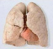 zdrava pljuča nekadilcev